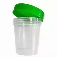 Avantal Urinbecher Bis 100 Ml Graduiert