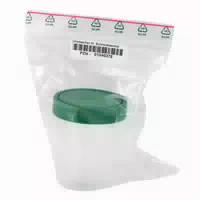 Urinbecher mit Schraubdeckel