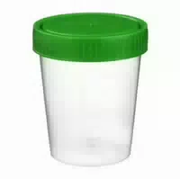 Urinbecher Mit Schraubdeckel 1 St