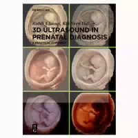 3d Ultrasound In Prenatal Diagnosis 1 St