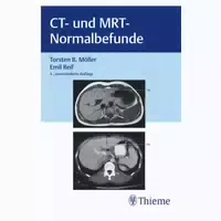 Ct Und Mrt Normalbefunde