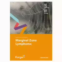 Fast Facts For Patients: Marginal Zone Lymphoma 1 St