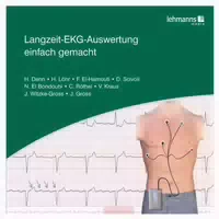 Langzeit Ekg Auswertung Einfach Gemacht 1 St