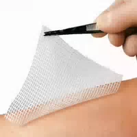 Lomatuell H 10 cm X 10 cm Steril