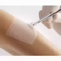 Lomatuell Pro 15x20 cm Steril 5 Stück