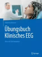 Übungsbuch Klinisches Eeg