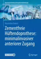 Zementfreie Hüftendoprothese: Minimalinvasiver Anteriorer Zugang